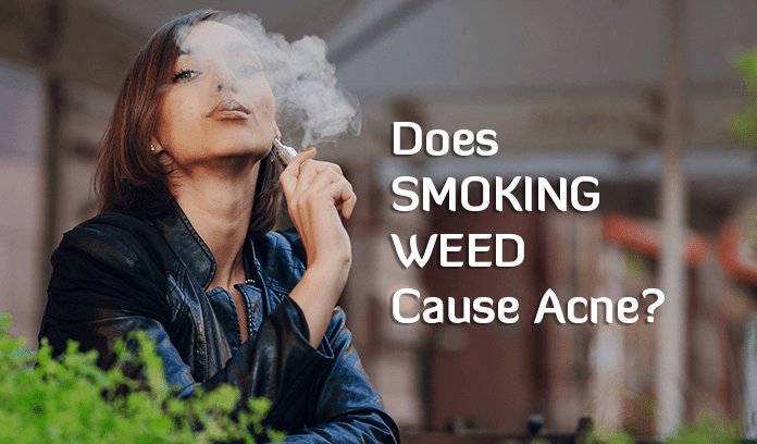 Does Smoking Weed Cause Acne