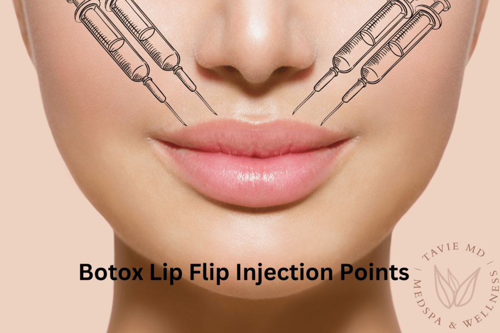 Injection Points