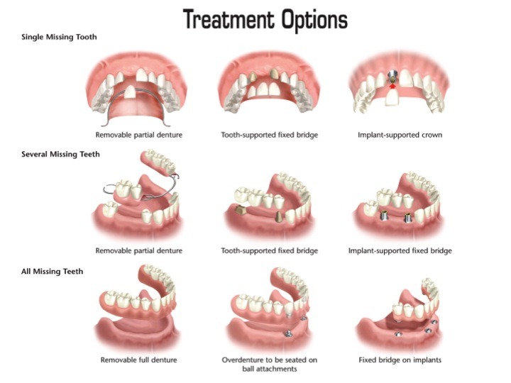 Forms of Dentitions