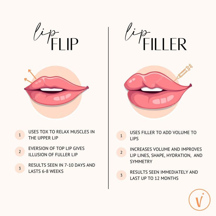 Lip Flip vs Filler