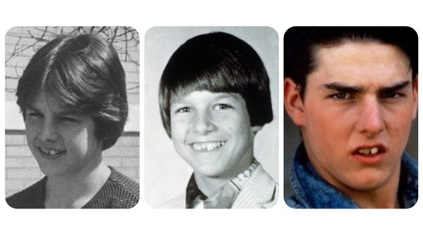 Childhood Tom Cruise Teeth