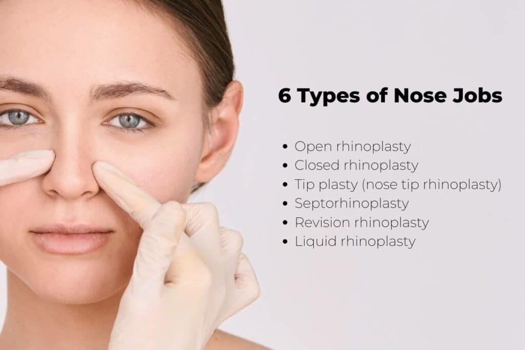 Nose Shape Alteration