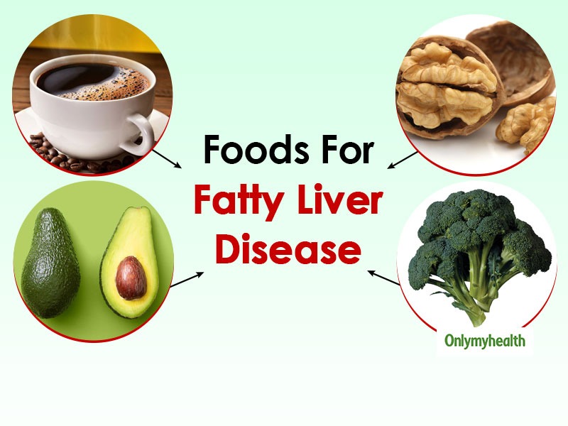 Foods for fatty liver