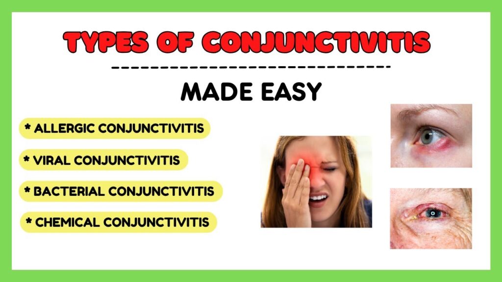 Conjunctivitis