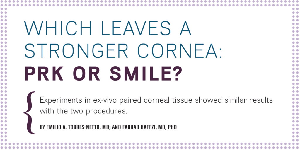 PRK and SMILE Comparisons