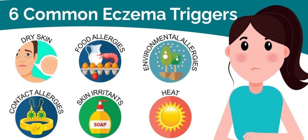 Eczema Triggers