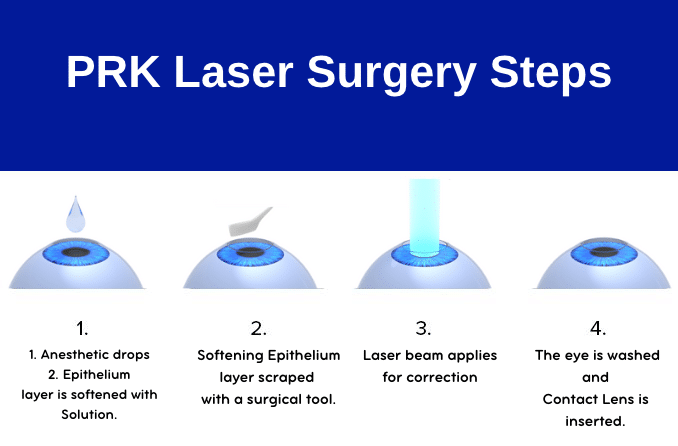 Photorefractive Keratectomy